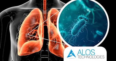 Il trattamento antilegionella di Alos Technologies